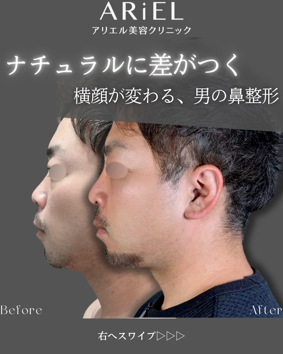 No.8929の症例写真